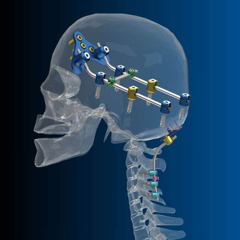 Cervical Posterior System
