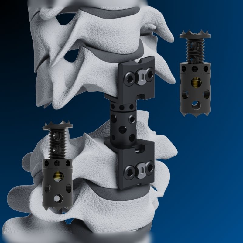 Intervertebral Replacement Systems